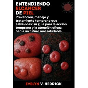 V. Herrick, Evelyn Entendiendo elcáncer de piel: Prevención, manejo y tratamiento temprano que salvavidas: su guía para la acción temprana y la atención eficaz hacia un futuro mássaludable V. Herrick, Evelyn Entendiendo elcáncer de piel: Prevención, manejo y tratamiento temprano que salvavidas: su guía para la acción temprana y la atención eficaz hacia un futuro mássaludable