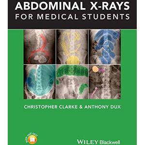 Clarke Abdominal X-rays for Medical Students Clarke Abdominal X-rays for Medical Students