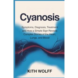 Wolff, Kith Cyanosis: Symptoms, Diagnosis, Treatment and How a Simple Sign Reveals Complex Stories of the Heart, Lungs, and Blood Wolff, Kith Cyanosis: Symptoms, Diagnosis, Treatment and How a Simple Sign Reveals Complex Stories of the Heart, Lungs, and Blood