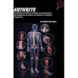 Taylor Arthrite: Comprendre les facteurs de risque, la reconnaissance des symptômes, les options de traitement et la gestion à long terme Taylor Arthrite: Comprendre les facteurs de risque, la reconnaissance des symptômes, les options de traitement et la gestion à long terme