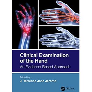 CRC Press Clinical Examination of the Hand: An Evidence-Based Approach CRC Press Clinical Examination of the Hand: An Evidence-Based Approach
