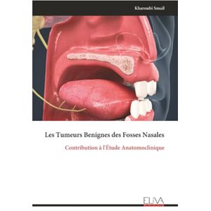 Smail, Kharoubi Les Tumeurs Benignes des Fosses Nasales: Contribution à l'Étude Anatomoclinique Smail, Kharoubi Les Tumeurs Benignes des Fosses Nasales: Contribution à l'Étude Anatomoclinique