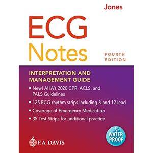 F.A. Davis ECG Notes: Interpretation and Management Guide F.A. Davis ECG Notes: Interpretation and Management Guide