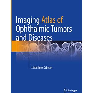 Allied Imaging Atlas of Ophthalmic Tumors and Diseases Allied Imaging Atlas of Ophthalmic Tumors and Diseases