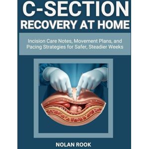 ROOK, NOLAN C-SECTION RECOVERY AT HOME: Incision care notes, movement plans, and pacing strategies for safer, steadier weeks ROOK, NOLAN C-SECTION RECOVERY AT HOME: Incision care notes, movement plans, and pacing strategies for safer, steadier weeks