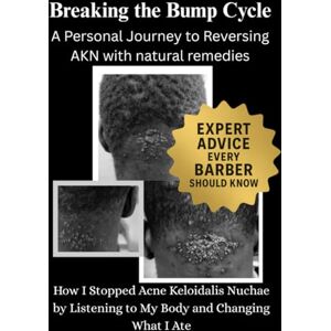 Lubangakene, Emmanuel Breaking the Bump Cycle: A Personal Journey to Reversing AKN with natural remedies: How I Stopped Acne Keloidalis Nuchae by Listening to My Body and Changing What I Ate Lubangakene, Emmanuel Breaking the Bump Cycle: A Personal Journey to Reversing AKN with natural remedies: How I Stopped Acne Keloidalis Nuchae by Listening to My Body and Changing What I Ate