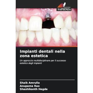 Amrulla, Shaik Impianti dentali nella zona estetica: Un approccio multidisciplinare per il successo estetico degli impianti Amrulla, Shaik Impianti dentali nella zona estetica: Un approccio multidisciplinare per il successo estetico degli impianti