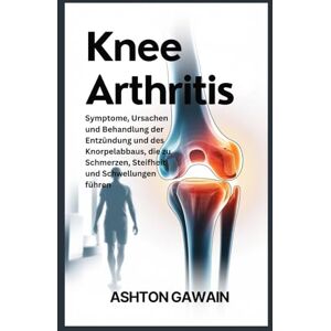 Ashton Knee Arthritis: Symptome, Ursachen und Behandlung der Entzündung und des Knorpelabbaus, die zu Schmerzen, Steifheit und Schwellungen führen Ashton Knee Arthritis: Symptome, Ursachen und Behandlung der Entzündung und des Knorpelabbaus, die zu Schmerzen, Steifheit und Schwellungen führen