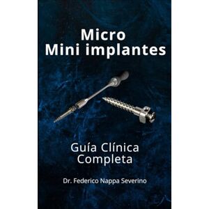 Nappa Severino, Dr. Federico Guía Clínica de Micro y Mini Implantes en Ortodoncia: Diagnóstico, planificación y aplicación clínica paso a paso Nappa Severino, Dr. Federico Guía Clínica de Micro y Mini Implantes en Ortodoncia: Diagnóstico, planificación y aplicación clínica paso a paso
