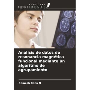 Babu N, Ramesh Análisis de datos de resonancia magnética funcional mediante un algoritmo de agrupamiento Babu N, Ramesh Análisis de datos de resonancia magnética funcional mediante un algoritmo de agrupamiento
