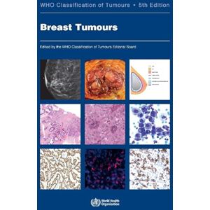 Lakhani, S.R. WHO Classification of Breast Tumours: WHO Classification of Tumours, Volume 2 (World Health Organization Classification of Tumours) Lakhani, S.R. WHO Classification of Breast Tumours: WHO Classification of Tumours, Volume 2 (World Health Organization Classification of Tumours)