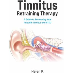 F., Helen Tinnitus Retraining Therapy: A Guide to Recovering from Pulsatile Tinnitus and PTSD F., Helen Tinnitus Retraining Therapy: A Guide to Recovering from Pulsatile Tinnitus and PTSD