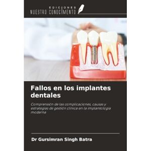 Batra, Dr Gursimran Singh Fallos en los implantes dentales: Comprensión de las complicaciones, causas y estrategias de gestión clínica en la implantología moderna Batra, Dr Gursimran Singh Fallos en los implantes dentales: Comprensión de las complicaciones, causas y estrategias de gestión clínica en la implantología moderna