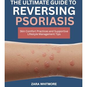 WHITMORE, ZARA THE ULTIMATE GUIDE TO REVERSING PSORIASIS: Skin Comfort Practices and Supportive Lifestyle Management Tips WHITMORE, ZARA THE ULTIMATE GUIDE TO REVERSING PSORIASIS: Skin Comfort Practices and Supportive Lifestyle Management Tips