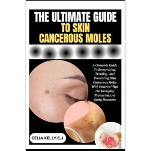 KELLY.C.J, CELIA THE ULTIMATE GUIDE TO SKIN CANCEROUS MOLES: A Complete Guide To Recognizing, Treating, And Preventing Skin Cancerous Moles With Practical Tips For Everyday Protection And Early Detection KELLY.C.J, CELIA THE ULTIMATE GUIDE TO SKIN CANCEROUS MOLES: A Complete Guide To Recognizing, Treating, And Preventing Skin Cancerous Moles With Practical Tips For Everyday Protection And Early Detection