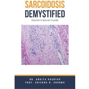Kashyap, Dr Ankita Sarcoidosis Demystified: Doctor's Secret Guide Kashyap, Dr Ankita Sarcoidosis Demystified: Doctor's Secret Guide