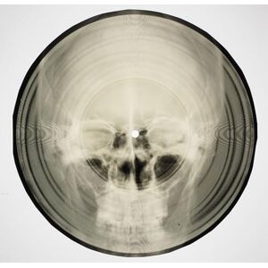 Coates, Stephen Bone Music: Soviet X-Ray Audio Coates, Stephen Bone Music: Soviet X-Ray Audio