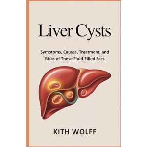 Wolff, Kith Liver Cysts: Symptoms, Causes, Treatment, and Risks of These Fluid-Filled Sacs Wolff, Kith Liver Cysts: Symptoms, Causes, Treatment, and Risks of These Fluid-Filled Sacs