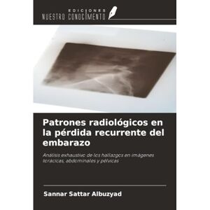 Albuzyad, Sannar Sattar Patrones radiológicos en la pérdida recurrente del embarazo: Análisis exhaustivo de los hallazgos en imágenes torácicas, abdominales y pélvicas Albuzyad, Sannar Sattar Patrones radiológicos en la pérdida recurrente del embarazo: Análisis exhaustivo de los hallazgos en imágenes torácicas, abdominales y pélvicas