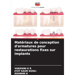 K R, Varshini Matériaux de conception d'armatures pour restaurations fixes sur implants K R, Varshini Matériaux de conception d'armatures pour restaurations fixes sur implants