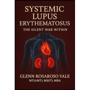 Vale, Glenn Rosaroso Systemic Lupus Erythematosus: The Silent War Within Vale, Glenn Rosaroso Systemic Lupus Erythematosus: The Silent War Within