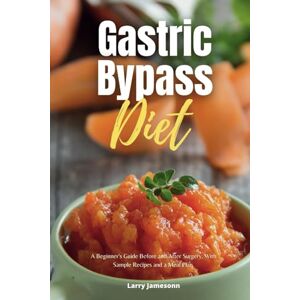 Jamesonn, Larry Gastric Bypass Diet: A Beginner's Guide Before and After Surgery, With Sample Recipes and a Meal Plan Jamesonn, Larry Gastric Bypass Diet: A Beginner's Guide Before and After Surgery, With Sample Recipes and a Meal Plan