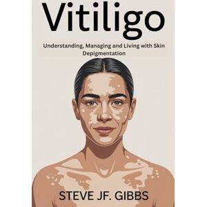Mercer, Keaton Elias Vitiligo: Understanding, Managing and Living with Skin Depigmentation Mercer, Keaton Elias Vitiligo: Understanding, Managing and Living with Skin Depigmentation
