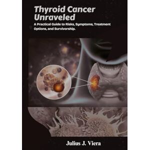 J. Viera, Julius Thyroid Cancer Unraveled: A Practical Guide to Risks, Symptoms, Treatment Options, and Survivorship. J. Viera, Julius Thyroid Cancer Unraveled: A Practical Guide to Risks, Symptoms, Treatment Options, and Survivorship.