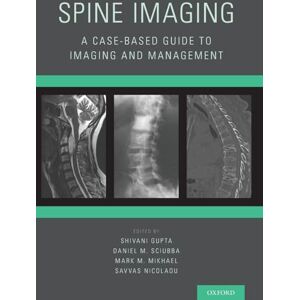 Spine Imaging: A Case-Based Guide to Imaging and Management Spine Imaging: A Case-Based Guide to Imaging and Management