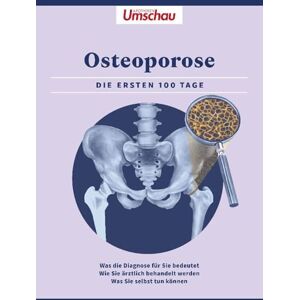 Apotheken Umschau: Osteoporose: Die ersten 100 Tage. Was die Diagnose bedeutet Wie Sie ärztlich behandelt werden Was Sie selbst tun können Apotheken Umschau: Osteoporose: Die ersten 100 Tage. Was die Diagnose bedeutet Wie Sie ärztlich behandelt werden Was Sie selbst tun können