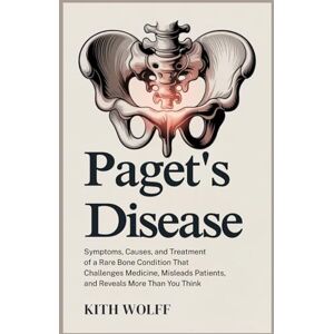 Wolff, Kith Paget’s Disease: Symptoms, Causes, and Treatment of a Rare Bone Condition That Challenges Medicine, Misleads Patients, and Reveals More Than You Think Wolff, Kith Paget’s Disease: Symptoms, Causes, and Treatment of a Rare Bone Condition That Challenges Medicine, Misleads Patients, and Reveals More Than You Think