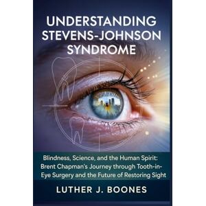 BOONES, LUTHER J. Understanding Stevens-Johnson syndrome: Blindness, Science, and the Human Spirit: Brent Chapman’s Journey through Tooth-in-Eye Surgery and the Future of Restoring Sight BOONES, LUTHER J. Understanding Stevens-Johnson syndrome: Blindness, Science, and the Human Spirit: Brent Chapman’s Journey through Tooth-in-Eye Surgery and the Future of Restoring Sight