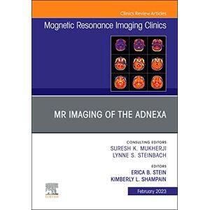 Elsevier Vascular Anesthesia, An Issue of Anesthesiology Clinics, E-Book (The Clinics: Internal Medicine) Elsevier Vascular Anesthesia, An Issue of Anesthesiology Clinics, E-Book (The Clinics: Internal Medicine)