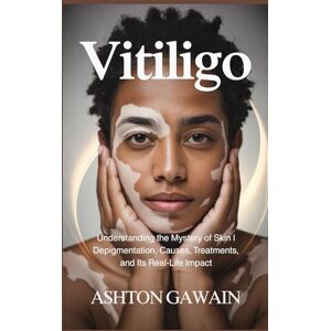 Ashton Vitiligo: Understanding the Mystery of Skin Depigmentation, Causes, Treatments, and Its Real-Life Impact Ashton Vitiligo: Understanding the Mystery of Skin Depigmentation, Causes, Treatments, and Its Real-Life Impact