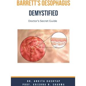 Kashyap, Dr Ankita Barretts Oesophagus Demystified: Doctor's Secret Guide Kashyap, Dr Ankita Barretts Oesophagus Demystified: Doctor's Secret Guide