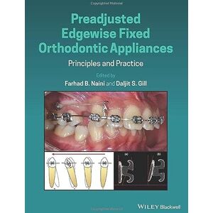 Preadjusted Edgewise Fixed Orthodontic Appliances: Principles and Practice Preadjusted Edgewise Fixed Orthodontic Appliances: Principles and Practice