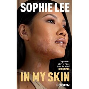 Lee In My Skin: Learning to love your perfectly imperfect life (Katie Piper's The UnSeen) Lee In My Skin: Learning to love your perfectly imperfect life (Katie Piper's The UnSeen)