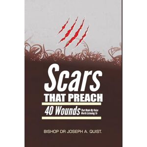 Quist, Bish Bishop Dr. Joseph A. SCARS THAT PREACH: 40 Wounds That Made My Voice Worth Listening To (The Legacy and Leadership Series: A Prophet’s Journey Through 40 Years of Ministry) Quist, Bish Bishop Dr. Joseph A. SCARS THAT PREACH: 40 Wounds That Made My Voice Worth Listening To (The Legacy and Leadership Series: A Prophet’s Journey Through 40 Years of Ministry)