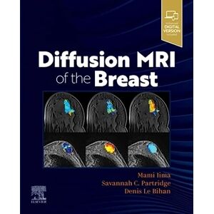 Diffusion MRI of the Breast Diffusion MRI of the Breast