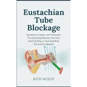 Wolff, Kith Eustachian Tube Blockage: Symptoms, Causes, and Treatment: The Surprising Reasons Your Ears Feel Full, Ring, or Hurt and What You Can Do About It Wolff, Kith Eustachian Tube Blockage: Symptoms, Causes, and Treatment: The Surprising Reasons Your Ears Feel Full, Ring, or Hurt and What You Can Do About It