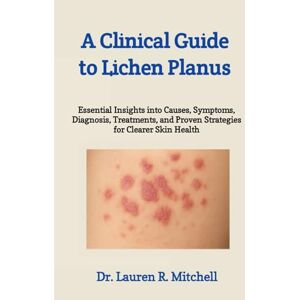 R. Mitchell, Dr. Lauren A Clinical Guide to Lichen Planus: Essential Insights into Causes, Symptoms, Diagnosis, Treatments, and Proven Strategies for Clearer Skin Health R. Mitchell, Dr. Lauren A Clinical Guide to Lichen Planus: Essential Insights into Causes, Symptoms, Diagnosis, Treatments, and Proven Strategies for Clearer Skin Health