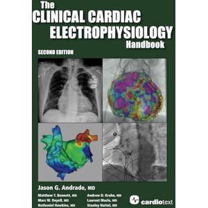 Andrade MD, Jason G. The Clinical Cardiac Electrophysiology Handbook Second Edition Andrade MD, Jason G. The Clinical Cardiac Electrophysiology Handbook Second Edition