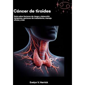 V. Herrick, Evelyn Cáncer de tiroides: Guía sobre factores de riesgo y detección temprana, opciones de tratamiento, manejo eficaz y más V. Herrick, Evelyn Cáncer de tiroides: Guía sobre factores de riesgo y detección temprana, opciones de tratamiento, manejo eficaz y más