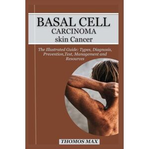 MAX, THOMOS BASAL CELL CARCINOMA SKIN CANCER: The Illustrated Guide: Types, Diagnosis, Prevention, Test, Management, Resources And Questions to ask your doctors. MAX, THOMOS BASAL CELL CARCINOMA SKIN CANCER: The Illustrated Guide: Types, Diagnosis, Prevention, Test, Management, Resources And Questions to ask your doctors.