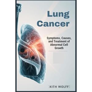 Wolff, Kith Lung Cancer: Symptoms, Causes, and Treatment of Abnormal Cell Growth Wolff, Kith Lung Cancer: Symptoms, Causes, and Treatment of Abnormal Cell Growth