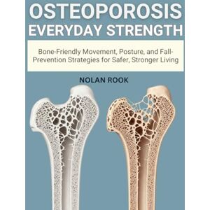ROOK, NOLAN OSTEOPOROSIS EVERYDAY STRENGTH: Bone-friendly movement, posture, and fall-prevention strategies for safer, stronger living ROOK, NOLAN OSTEOPOROSIS EVERYDAY STRENGTH: Bone-friendly movement, posture, and fall-prevention strategies for safer, stronger living