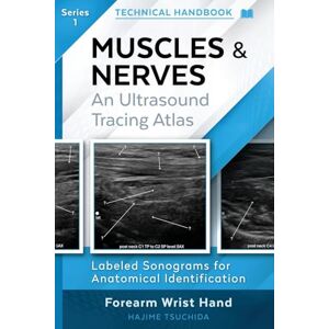 TSUCHIDA, HAJIME TECHNICAL ULTRASOUND HANDBOOK MUSCLES & NERVES: An Ultrasound Tracing Atlas (Series 1) (1) TSUCHIDA, HAJIME TECHNICAL ULTRASOUND HANDBOOK MUSCLES & NERVES: An Ultrasound Tracing Atlas (Series 1) (1)