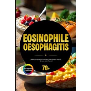Excellence, Chef Eosinophile Ösophagitis: Wie du Schluckbeschwerden überwindest und mit Genuss essen kannst Excellence, Chef Eosinophile Ösophagitis: Wie du Schluckbeschwerden überwindest und mit Genuss essen kannst