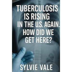 Vale, Sylvie Tuberculosis Is Rising In The U.S. Again. How Did We Get Here? Vale, Sylvie Tuberculosis Is Rising In The U.S. Again. How Did We Get Here?