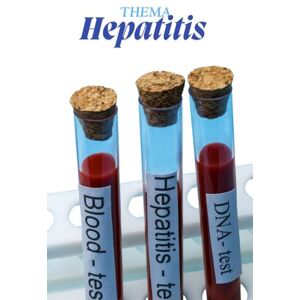 Pflegeleicht, Nadine „Hepatitis – Kompaktwissen für Pflegekräfte“. Pflegeausbildung Merksätze Infektionskrankheiten Pflege Praxiswissen Pflegekräfte Kompaktwissen ... Pflege – Die Kittelbuch-Reihe“) Pflegeleicht, Nadine „Hepatitis – Kompaktwissen für Pflegekräfte“. Pflegeausbildung Merksätze Infektionskrankheiten Pflege Praxiswissen Pflegekräfte Kompaktwissen ... Pflege – Die Kittelbuch-Reihe“)